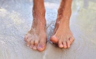 Going barefoot is the cause of fungus