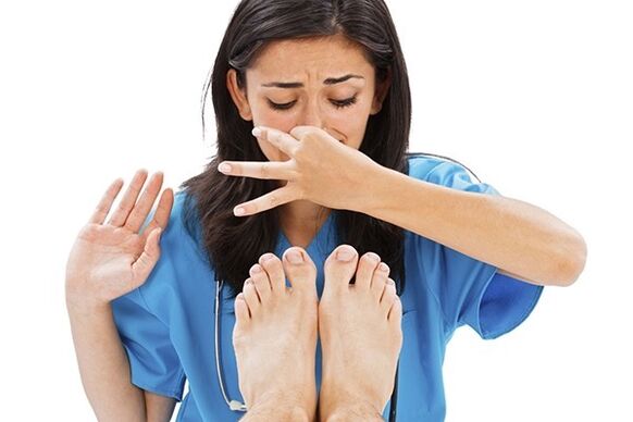 Severe foot odor due to nail fungus