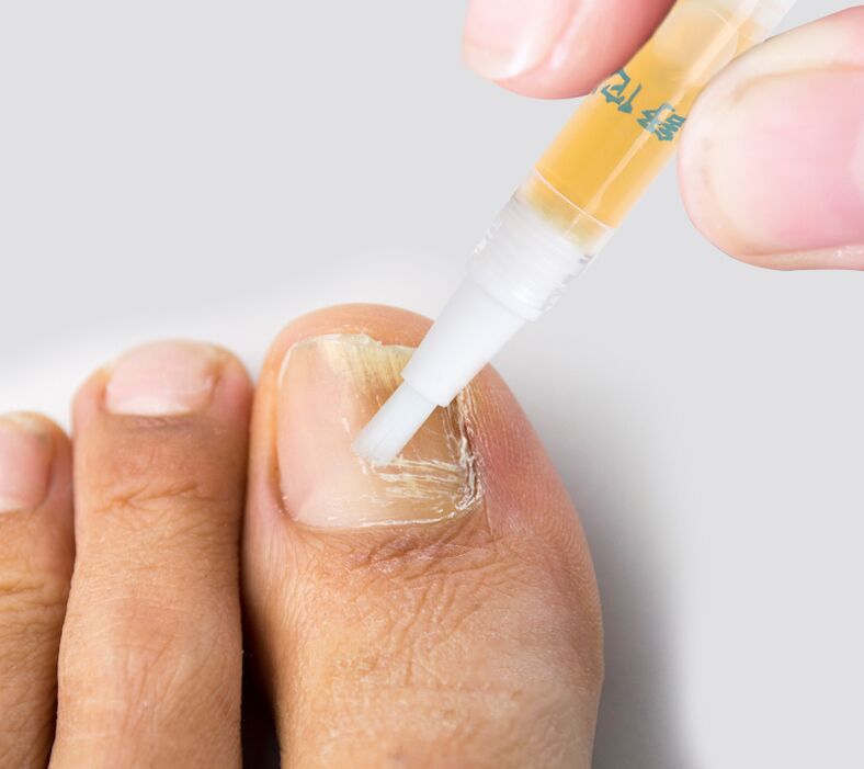 anti-fungal toenail liquid